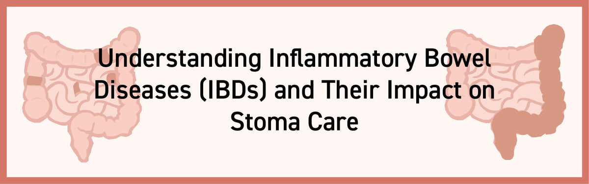 IBDs and their Impact on Stoma Care